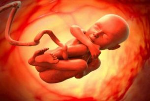 پیچیدگی بند ناف به دور گردن جنین در چه صورت خطرناک است؟