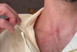 حمله سارقان به مهاجم سابق استقلال در اتوبان چمران تهران + عکس
