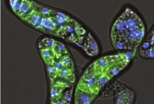 Amoebidium appalachense رنگ‌آمیزی شده با فالویدین همراه DNA (آبی)